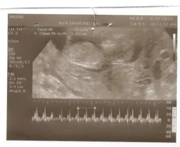 $Resim 025.webp $Resim 025.webp