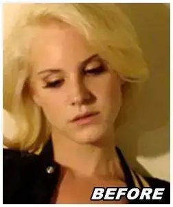 $Lana Del Rey plastic surgery.webp