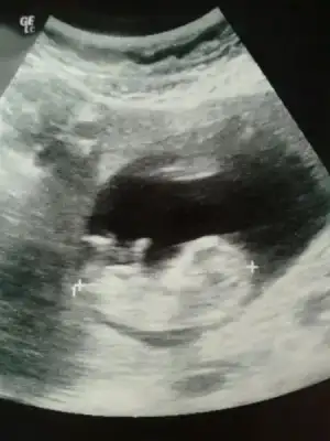 $1364571529253 (1).webp