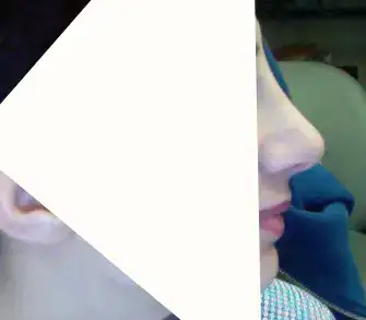 $ameliyat_3aysonra.webp
