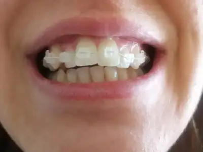 $1. g&#252;n nisan 10.webp