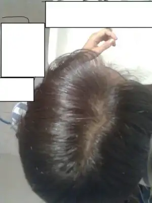 $GÃ¶rÃ¼ntÃ¼0358.webp
