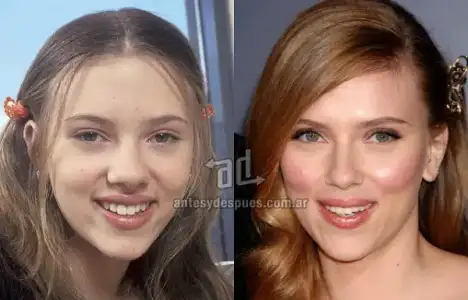 $Scarlett-Johansson_nariz-nosejob_www_antesydespues_com_ar.webp