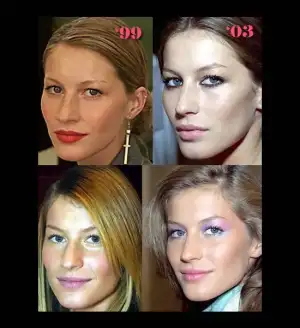 $giselle-bundchen-nose-job.webp