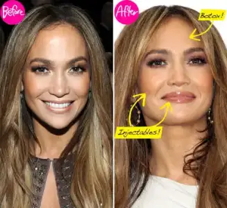 $jennifer_lopez_plastic_surgery.webp