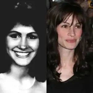 $celebrity_nose_job_17.webp