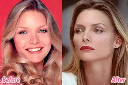 $michelle-pfeiffer-breast-implants.webp