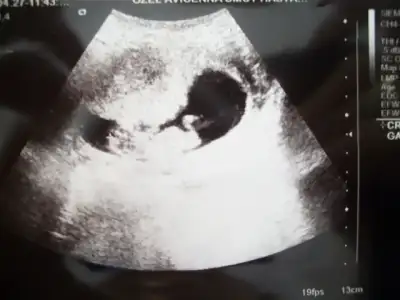 $101_5417 (640x480).webp