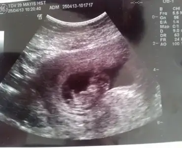 $2013-04-27 09.58.37-1.webp