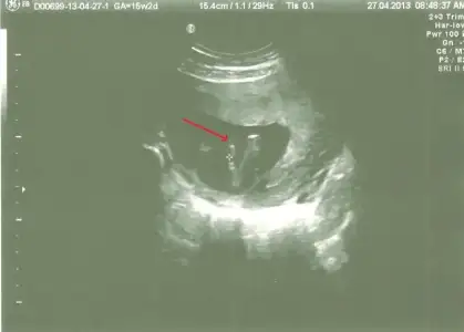 $15w2d - 002 (pipi).webp