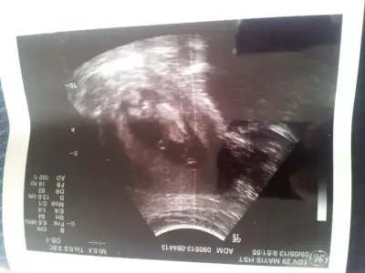 $2013-05-09 10.08.29.webp