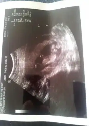 $2013-05-09 10.08.29-1.webp