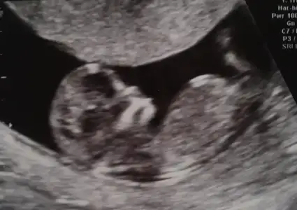 $2013-04-17 10.01.59.webp