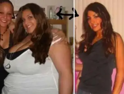 $130-extreme-weight-loss-before-after-women.webp $130-extreme-weight-loss-before-after-women.webp