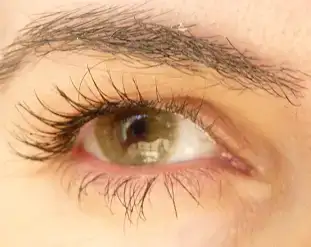 $h&#305;drocor mel3.webp