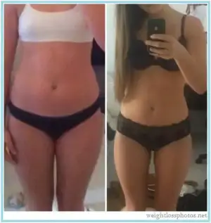 $303-weight-loss-before-after-women-thighs.webp