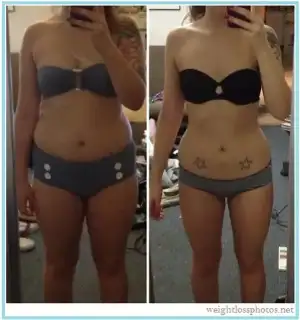 $305-weight-loss-before-after-women-thighs.webp