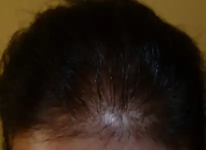 $k&#252;&#231;&#252;lm&#252;&#351; 1.webp