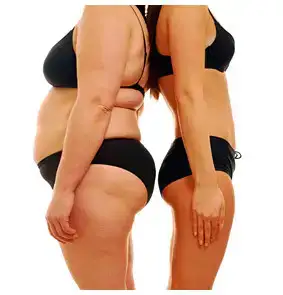 $before-and-after-weight-loss.webp $before-and-after-weight-loss.webp