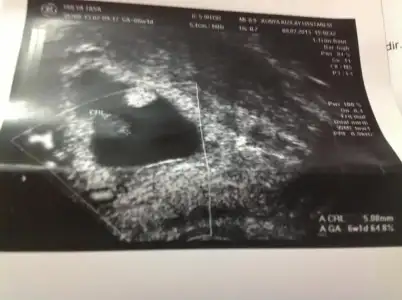 $image.webp $image.webp