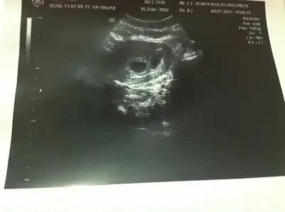 $image.webp $image.webp