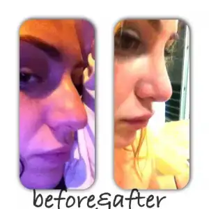 $before after.webp