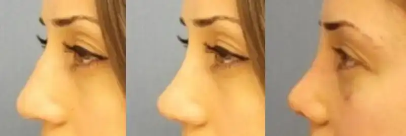 $eski tas yan.webp $eski tas yan.webp