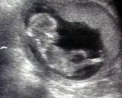 $12weeks_1.webp $12weeks_1.webp