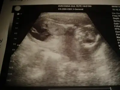 $2013-08-11 22.44.32.webp