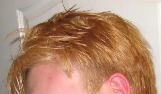 $Orange-hair-dye-disaster.webp $Orange-hair-dye-disaster.webp