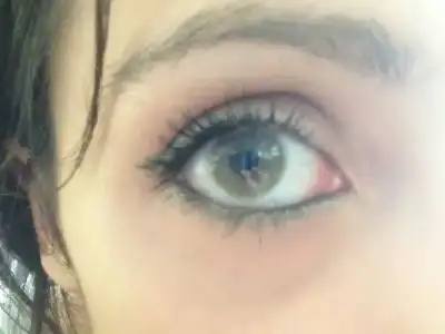 $h&#305;drocor mel yeni 3.webp