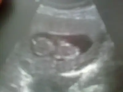 $Foto&#287;raf0118 (1).webp