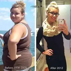 $before%20%20after.webp