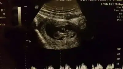 $&#231;ocuk foto.webp