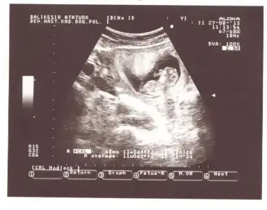 $BEB&#304;&#350; 001.webp