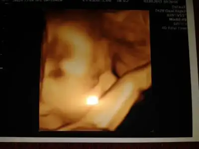 $Oglusum 27 hafta.webp