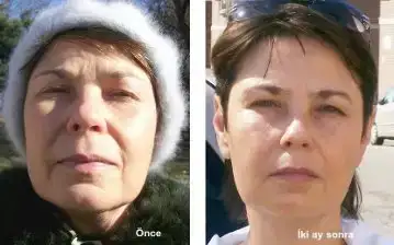 $Larissa before-after-s.webp