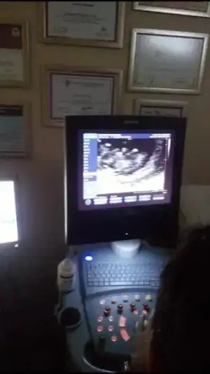 $1379515_10151865571859230_1069197394_n (1).webp