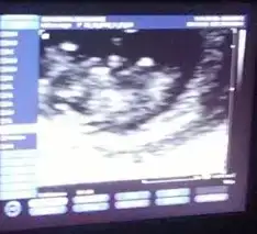 $1379515_10151865571859230_1069197394_n (1).webp