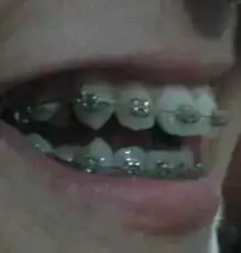 $2013-11-08 18.11.10-1.webp