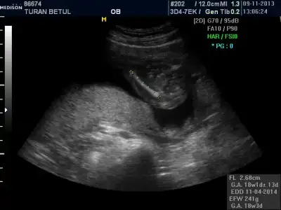 $BABY 9-11-2013_5.webp $BABY 9-11-2013_5.webp
