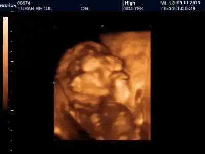 $BABY 9-11-2013_2.webp $BABY 9-11-2013_2.webp