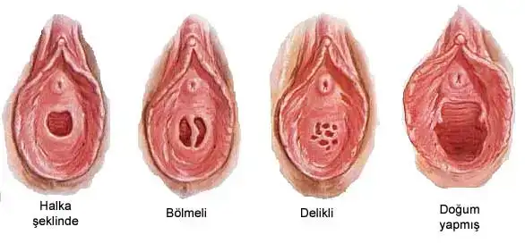 $bekaret.webp