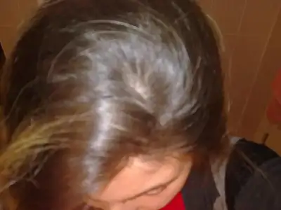 $tepeden flaşsız.webp $tepeden flaşsız.webp