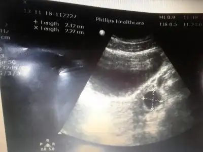 $2013-11-18 18.02.03.webp