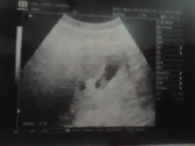 $2013-11-05 22.21.02.webp