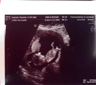 $ultraschall3.webp