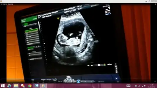 $Screenshot (208).webp