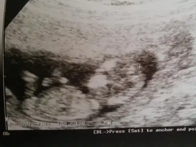 $20140107_123507 (2).webp