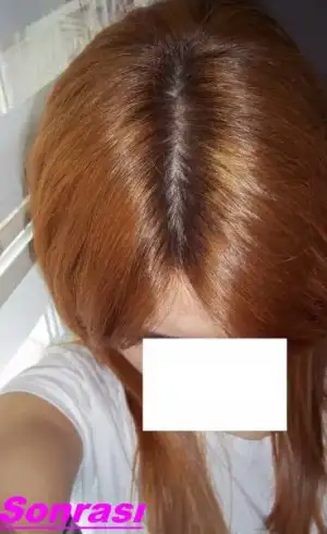 $100_2858.webp